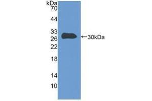 Detection of Recombinant TLN, Human using Polyclonal Antibody to Talin 1 (TLN1) (TLN1 Antikörper  (AA 2293-2536))