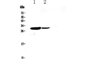 Western blot analysis of IL17C using anti-IL17C antibody . (IL17C Antikörper  (AA 19-197))