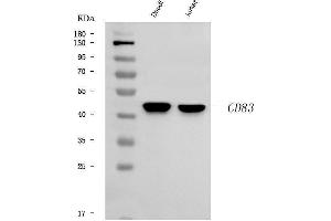 Western blot analysis of ADAM22 using anti-ADAM22 antibody (ABIN7600519).