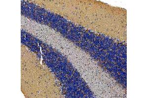 IHC analysis of SLC6A1 using anti-SLC6A1 antibody (ABIN5518957). (SLC6A1 Antikörper  (N-Term))