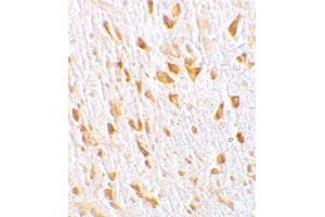 Immunohistochemistry of AGAP2 in mouse brain tissue with AGAP2 polyclonal antibody  at 10 ug/mL .