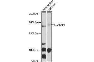CECR2 Antikörper  (AA 170-370)