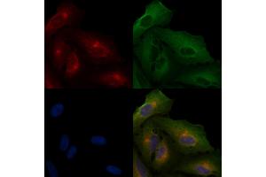 ABIN6265066 and ABIN6266633 staining  cells by IF/ICC. (INPP5D Antikörper  (C-Term))