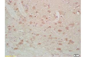 Formalin-fixed and paraffin embedded rat brain labeled with Anti-FABPB Polyclonal Antibody, Unconjugated (ABIN677888) at 1:200, followed by conjugation to the secondary antibody and DAB staining