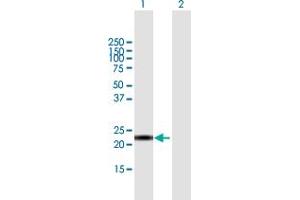 Western Blot analysis of CALML6 expression in transfected 293T cell line by CALML6 MaxPab polyclonal antibody. (CALML6 Antikörper  (AA 1-181))