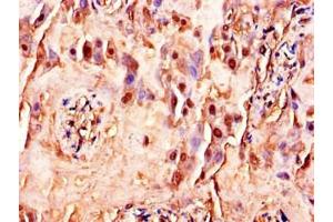 Immunohistochemistry of paraffin-embedded human placenta tissue using ABIN7175388 at dilution of 1:100