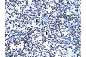 Image no. 2 for anti-Glial Cells Missing Homolog 1 (GCM1) (N-Term) antibody (ABIN6735857) (GCM1 Antikörper  (N-Term))