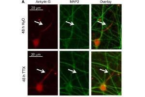 Cultured rat hippocampal neurons (DIV 11-12) were treated for 48 h with 1 μM TTX or its vehicle control (0. (Ankyrin G Antikörper)