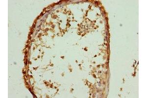 Immunohistochemistry of paraffin-embedded human testis tissue using ABIN7147043 at dilution of 1:100 (M6PR Antikörper  (AA 1-277))