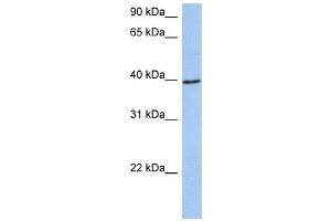 ACADM antibody used at 1 ug/ml to detect target protein. (Medium-Chain Specific Acyl-CoA Dehydrogenase, Mitochondrial (N-Term) Antikörper)