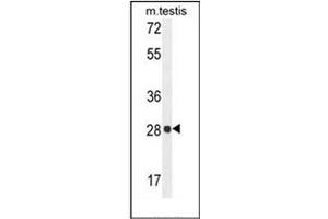 Western blot analysis of PGAM2 Antibody (N-term) in mouse testis tissue lysates (35ug/lane).