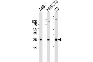 Western blot analysis of lysates from A431, mouse NIH/3T3, rat C6 cell line (from left to right), using RAC1 Antibody (ABIN6242819 and ABIN6577074). (RAC1 Antikörper)