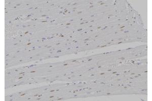 ABIN6266166 and ABIN6277199 at 1/100 staining Rat heart tissue by IHC-P.