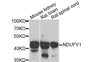 Western blot analysis of extracts of various cell lines, using NDUFV1 antibody. (NDUFV1 Antikörper  (AA 1-250))