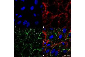 Immunocytochemistry/Immunofluorescence analysis on non-permeabilized HCT116 cells using Mouse Anti-HSP70 Monoclonal Antibody, Clone 1H11: FITC conjugate  showing cell membrane staining. (HSP70 Antikörper  (APC))