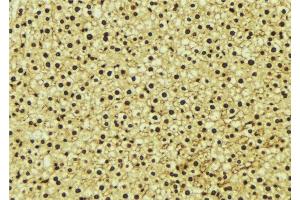ABIN6277243 at 1/100 staining Mouse liver tissue by IHC-P. (PSMA1 Antikörper  (C-Term))