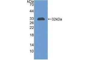 Detection of Recombinant CR1, Human using Polyclonal Antibody to Complement Receptor 1, Erythrocyte (CR1) (CD35 Antikörper  (AA 1780-2039))