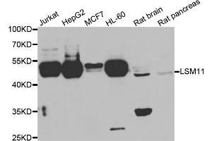 Western blot analysis of extracts of various cell lines, using LSM11 antibody (ABIN5975590) at 1/1000 dilution. (LSM11 Antikörper)