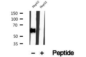 Western blot analysis of extracts of HepG2 cells, using DBR1 antibody. (DBR1 Antikörper)