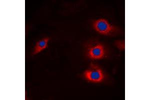 Immunofluorescence (IF) image for anti-HECT, C2 and WW Domain Containing E3 Ubiquitin Protein Ligase 2 (HECW2) (Center) antibody (ABIN7299666)