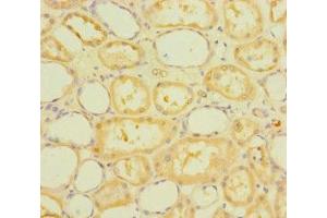 Immunohistochemistry of paraffin-embedded human kidney tissue using ABIN7168465 at dilution of 1:100 (RUFY4 Antikörper  (AA 174-473))