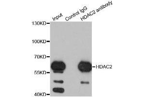 Immunoprecipitation analysis of 200ug extracts of K562 cells using 1ug HDAC2 antibody.