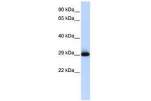 Image no. 1 for anti-Sushi Domain Containing 3 (SUSD3) (AA 35-84) antibody (ABIN6741328) (SUSD3 Antikörper  (AA 35-84))