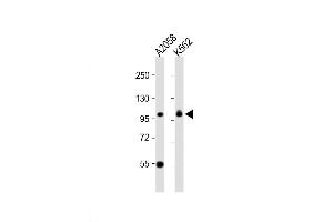 Western Blot at 1:1000 dilution Lane 1: A2058 whole cell lysate Lane 2: K562 whole cell lysate Lysates/proteins at 20 ug per lane.