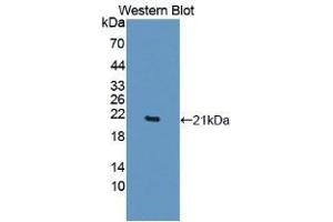 Western blot analysis of recombinant Human TNFa. (TNF alpha Antikörper  (AA 77-233))