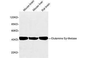 Western blot analysis of tissue lysates using 1 µg/mL Rabbit Anti-Glutamine Synthetase Polyclonal Antibody (ABIN398821) The signal was developed with IRDyeTM 800 Conjugated Goat Anti-Rabbit IgG. (GLN1 Antikörper  (AA 300-350))