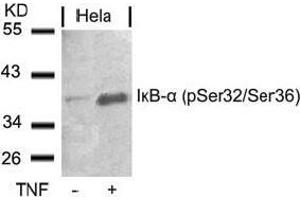 Image no. 3 for anti-Nuclear Factor of kappa Light Polypeptide Gene Enhancer in B-Cells Inhibitor, alpha (NFKBIA) (pSer32), (pSer36) antibody (ABIN196874)
