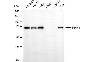 Western blotting analysis using IRAK1 antibody (ABIN7799112). (Rekombinanter IRAK1 Antikörper)