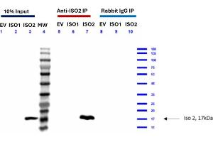 Feimin (Isoform 2) Immunoprecipitation (IP) followed by Western Blot (WB) analyses. (Feimin (N-Term) Antikörper)