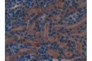 Detection of CFH in Mouse Kidney Tissue using Polyclonal Antibody to Complement Factor H (CFH)