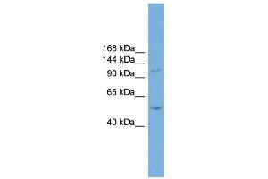 TNNI3K antibody used at 1 ug/ml to detect target protein. (TNNI3K Antikörper  (N-Term))