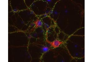 Indirect immunostaining of PFA fixed rat hippocampus neurons with anti-HCN 1 (dilution 1 : 500; red) and mouse anti-synapsin 1 (cat.