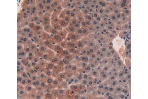 Used in DAB staining on fromalin fixed paraffin- embedded liver tissue (UQCRB Antikörper  (AA 3-111))