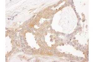 Immunohistochemistry (IHC) image for anti-Chaperonin Containing TCP1, Subunit 8 (Theta) (CCT8) (AA 1-50) antibody (ABIN7453618) (CCT8 Antikörper  (AA 1-50))
