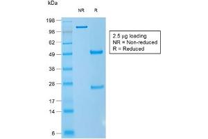 SDS-PAGE analysis of purified, BSA-free recombinant CD1a antibody (clone rC1A/711) as confirmation of integrity and purity. (CD1a Antikörper)