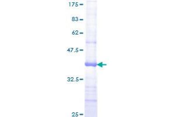 JAG2 Protein (AA 121-210) (GST tag)