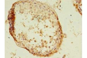 Immunohistochemistry of paraffin-embedded human testis tissue using ABIN7157249 at dilution of 1:100 (KBTBD4 Antikörper  (AA 151-415))