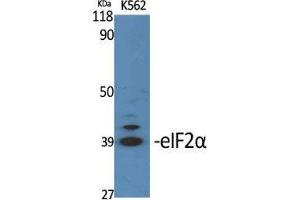 Western Blot (WB) analysis of specific cells using eIF2alpha Polyclonal Antibody. (EIF2A Antikörper  (Ser326))