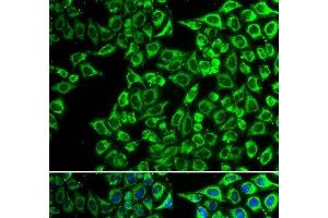 Immunofluorescence analysis of A549 cells using LIPC Polyclonal Antibody (LIPC Antikörper)