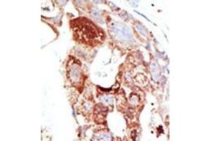 Image no. 2 for anti-SUMO1/sentrin Specific Protease 6 (SENP6) (C-Term) antibody (ABIN356759) (SENP6 Antikörper  (C-Term))