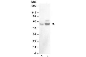 Western blot testing of 1) rat testis and 2) mouse testis with ALDH1A2 antibody at 0. (ALDH1A2 Antikörper)
