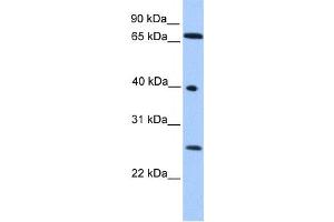 Western Blotting (WB) image for anti-Lethal(3) Malignant Brain Tumor-Like Protein 2 (L3MBTL2) antibody (ABIN2457889) (L3MBTL2 Antikörper)