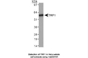 Image no. 1 for anti-Telomeric Repeat Binding Factor (NIMA-Interacting) 1 (TERF1) antibody (ABIN363255) (TRF1 Antikörper)