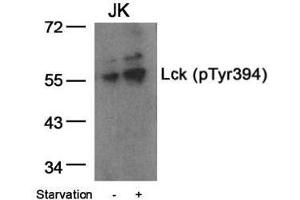 Image no. 1 for anti-Lymphocyte-Specific Protein tyrosine Kinase (LCK) (pTyr394) antibody (ABIN196861) (LCK Antikörper  (pTyr394))
