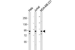 All lanes : Anti-MYSM1 Antibody (N-term) at 1:1000 dilution Lane 1: Hela whole cell lysate Lane 2: Jurkat whole cell lysate Lane 3: MDA-MB-231 whole cell lysate Lysates/proteins at 20 μg per lane. (MYSM1 Antikörper  (N-Term))