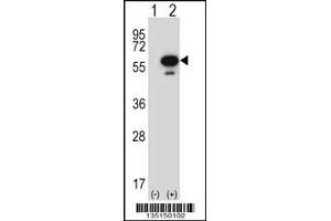 Western blot analysis of Stk25 using rabbit polyclonal Mouse Stk25 Antibody using 293 cell lysates (2 ug/lane) either nontransfected (Lane 1) or transiently transfected (Lane 2) with the Stk25 gene. (STK25 Antikörper  (C-Term))